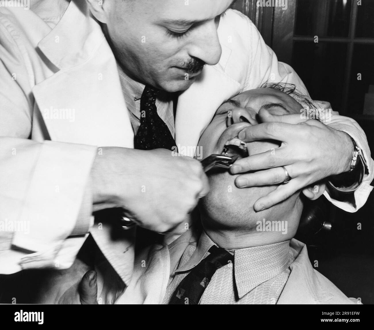États-Unis : c. 1933 Un patient qui obtient une dent extraite par un dentiste. Banque D'Images