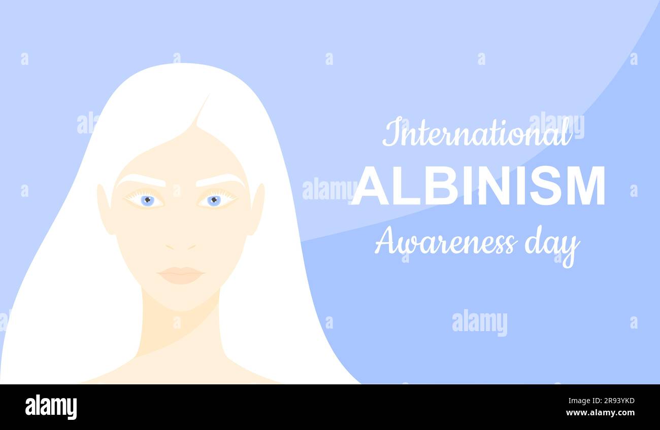 Belle femme albino sur un fond bleu pâle. Journée internationale de sensibilisation à l'albinisme Illustration de Vecteur