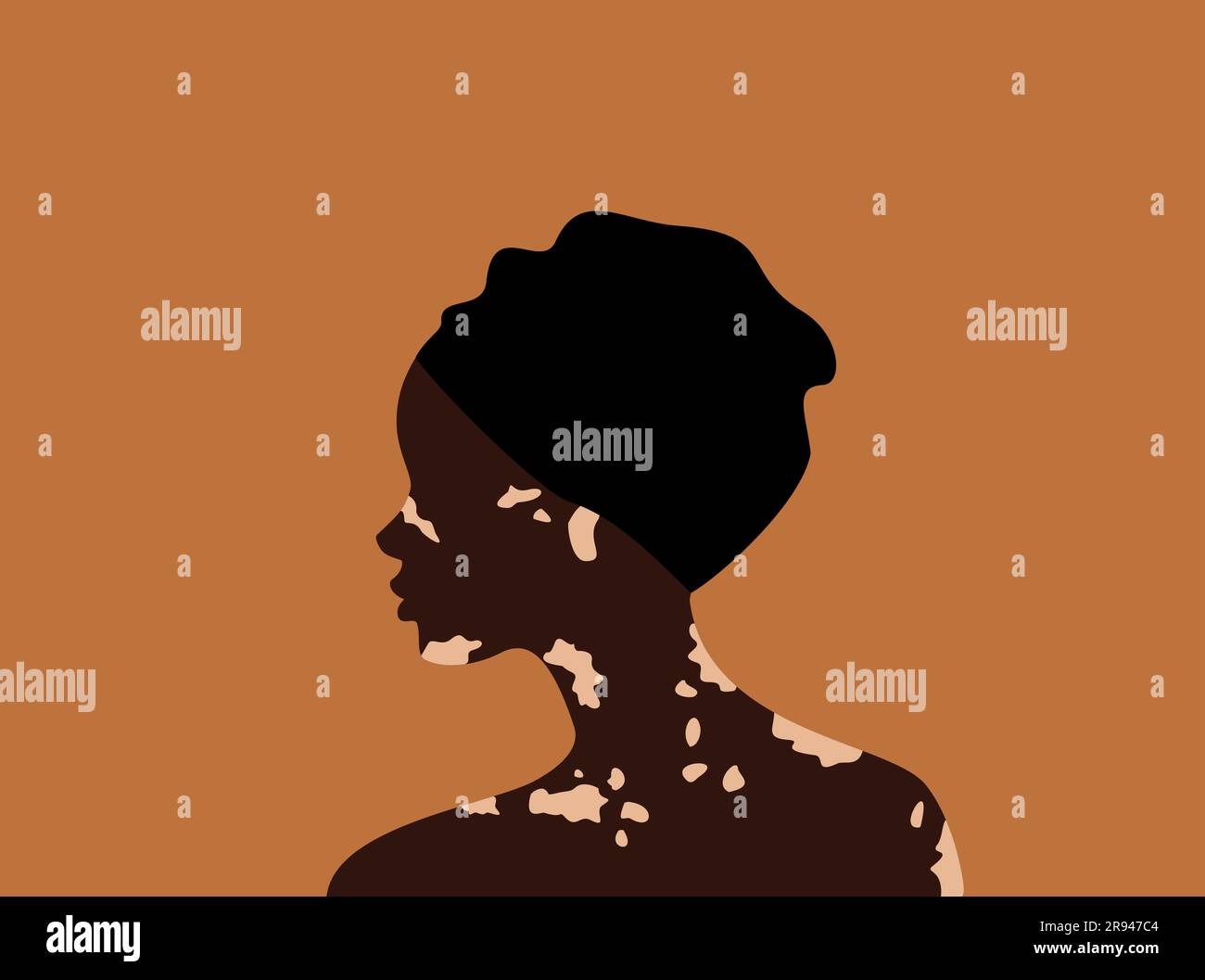 Vue latérale de la femme africaine en turban avec le vitiligo sur fond orange. Concept positif du corps. Illustration vectorielle plate Illustration de Vecteur