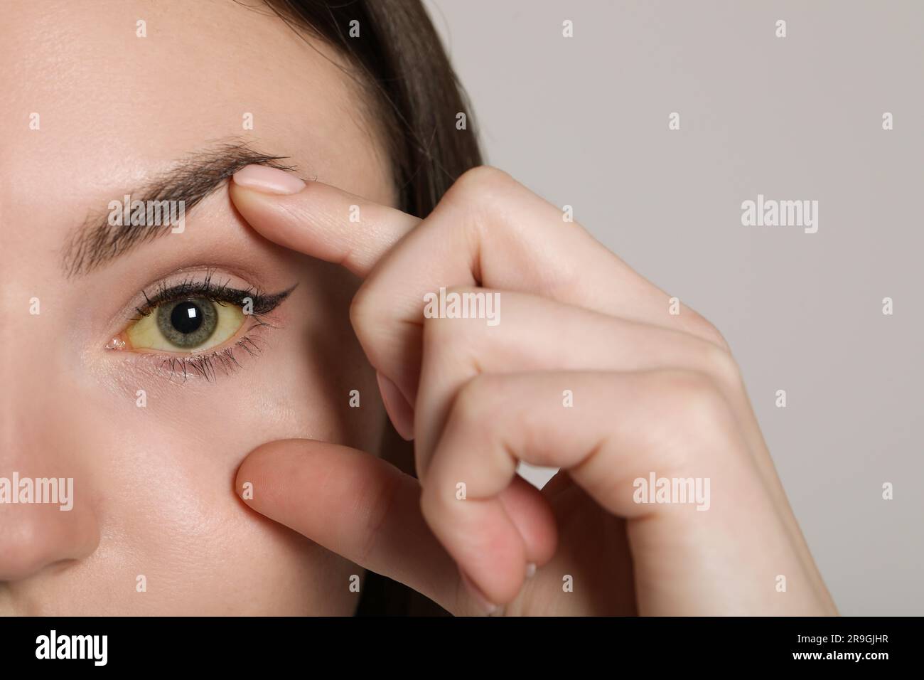 Femme vérifiant son état de santé sur fond gris clair, gros plan. Yeux jaunes comme symptôme de l'hépatite Banque D'Images
