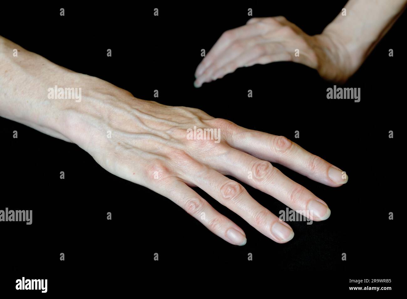 Différentes positions de senior woman's hands sur fond noir Banque D'Images