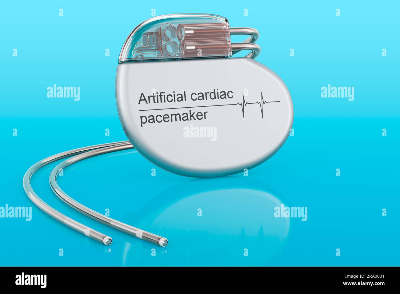 Stimulateur cardiaque artificiel sur fond bleu, rendu 3D Banque D'Images