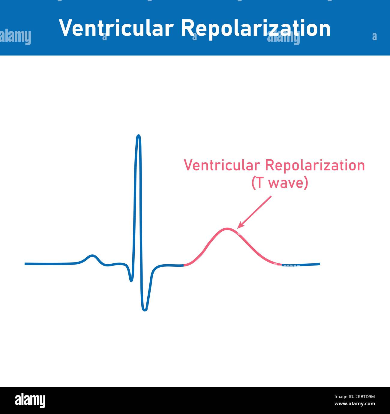 Repolarisation ventriculaire, onde T. L'intervalle QT de l'ECG. Le cycle cardiaque. ECG du coeur en rythme sinusal normal. Ressources pour les enseignants Illustration de Vecteur