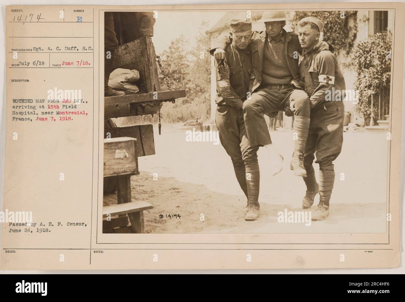 Un soldat blessé de la 2e division arrive au 15e hôpital de campagne près de Montreuial, en France, le 7 juin 1918. La photographie a été prise par le sergent A. C. Duff, S.C. Il a été adopté par le censeur de l'A. E. F. le 24 juin 1918, et le nombre négatif est 14174. Banque D'Images