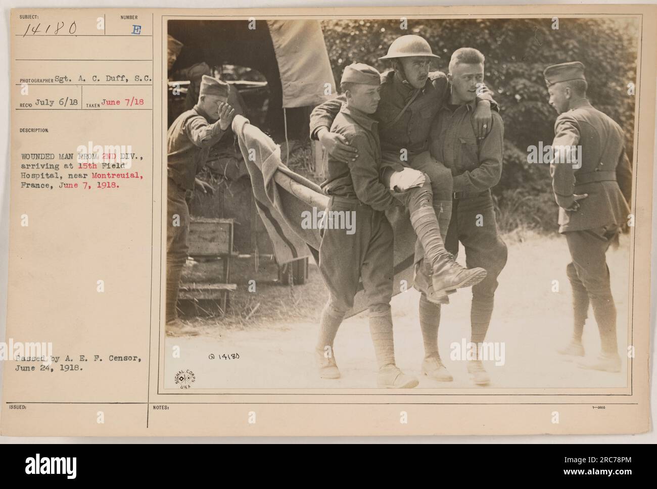 Un blessé de la 2e division arrive au 15e hôpital de campagne près de Montreuil, en France, le 7 juin 1918. La photographie a été prise par le sergent A.C. Duff. Il a été émis et adopté par l'A.E.F. Censurer le 24 juin 1918. Le numéro de référence de l'image est 14180. Banque D'Images