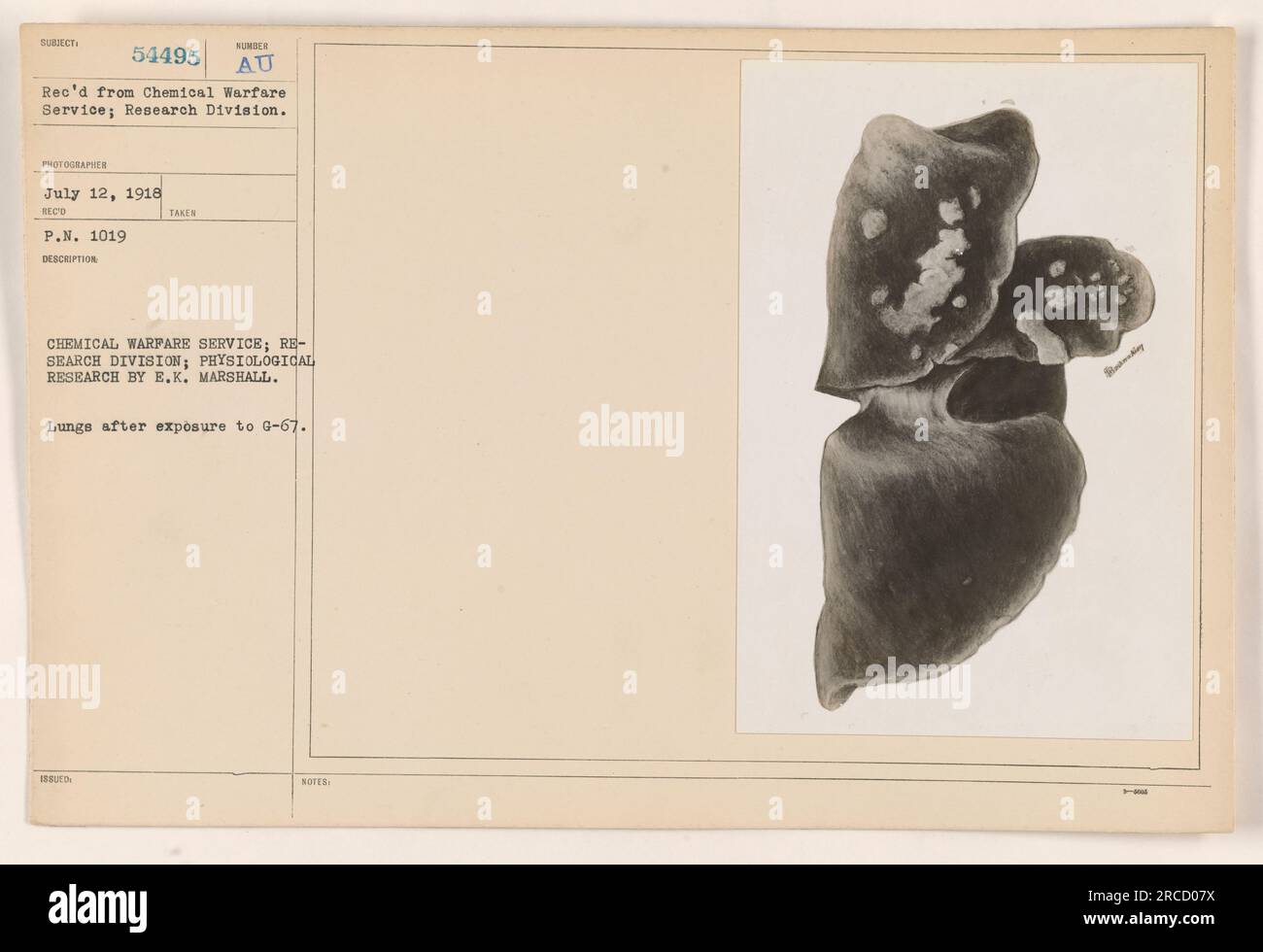 Poumons après exposition à un agent chimique G-67. Cette photographie a été prise le 12 juillet 1918 dans le cadre d'une recherche menée par E.K. Marshall dans la division de recherche du Chemical Warfare Service. Le numéro du sujet est le 54495. Cette image montre les effets du G-67 sur les poumons. Banque D'Images