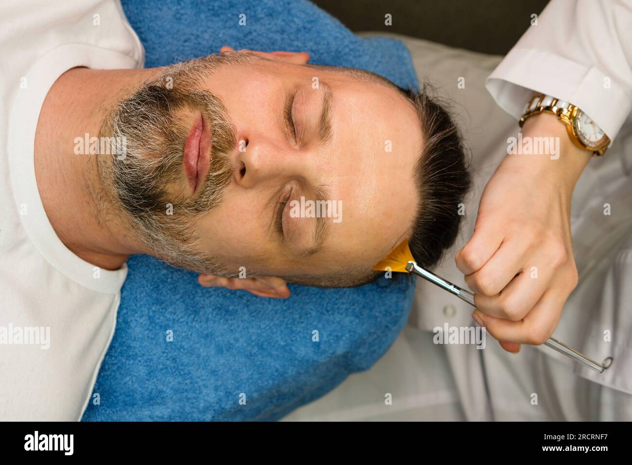 Bel homme barbu pendant la procédure de peeling du visage dans le salon de beauté. Peeling chimique du visage. Soins de la peau et traiter la peau Banque D'Images