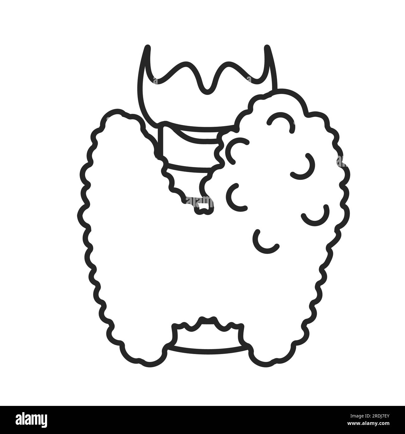 Hypertrophie de la glande thyroïde, illustration Banque D'Images