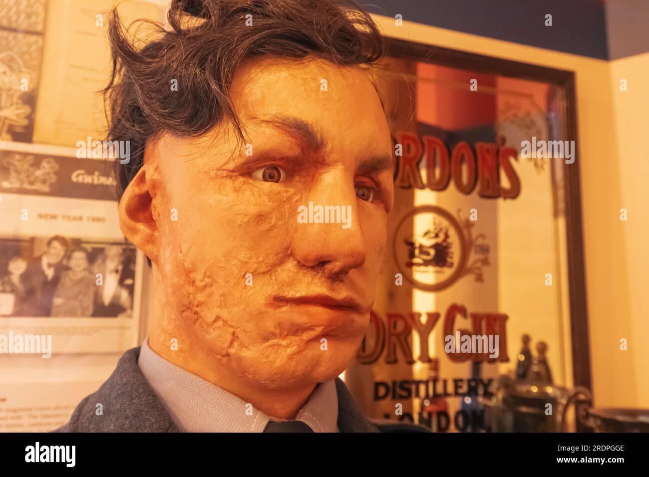 Angleterre, Sussex, West Sussex, East Grinstead, East Grinstead Museum, Exposition d'un patient greffé de peau défigurée dans un pub local Banque D'Images
