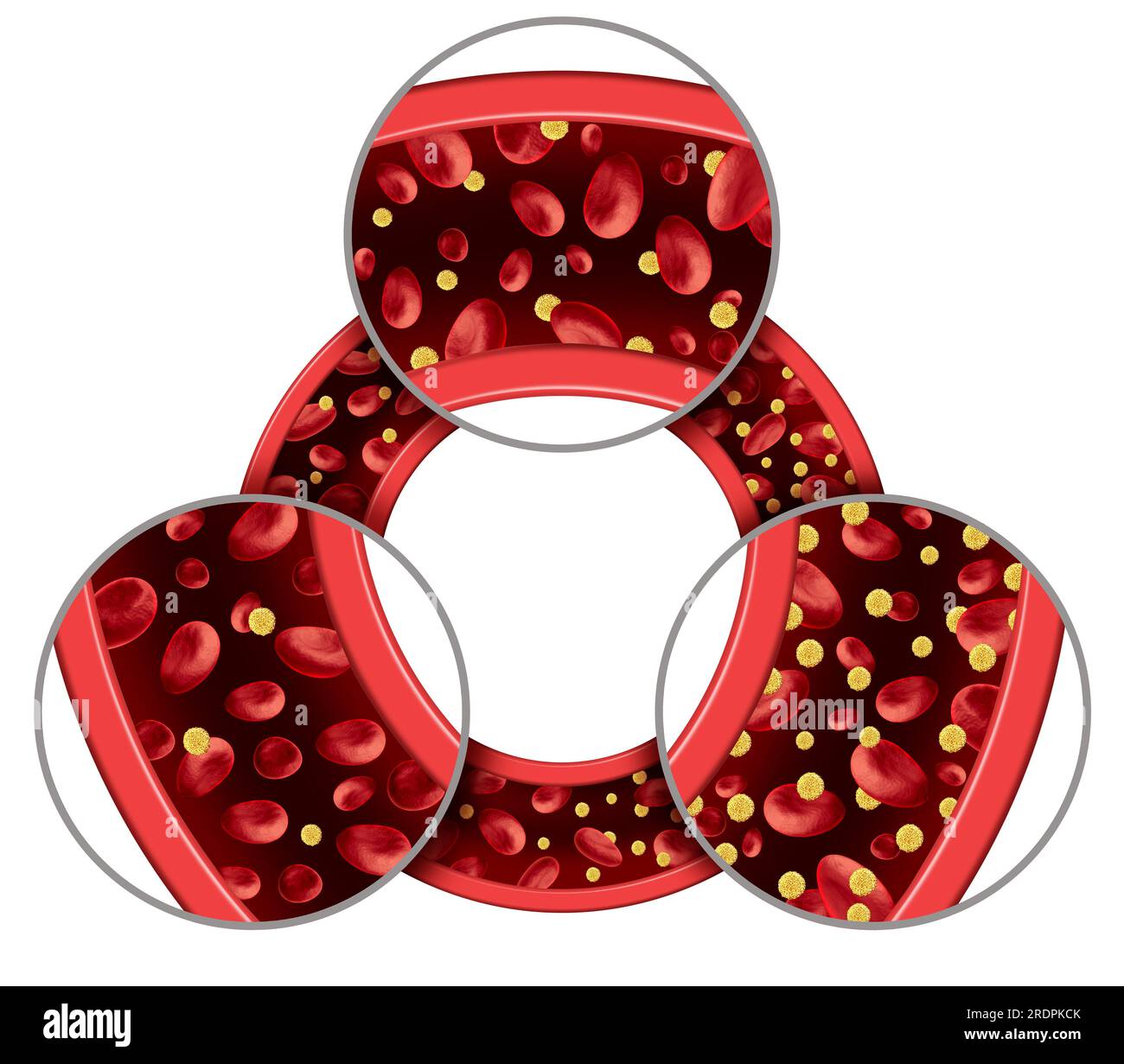 Glucose dans le sang comme symbole de l'hypoglycémie et de l'hyperglycémie ou taux de glucose normal comme diabète ou symbole diabétique comme faible ou élevé sucre dans le sang Banque D'Images