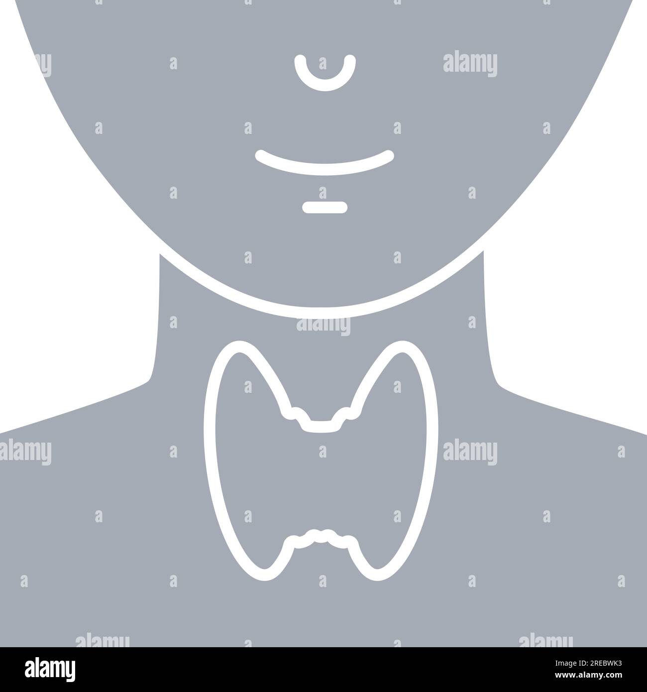 Hypertrophie de la glande thyroïde sur le schéma de silhouette du cou Illustration de Vecteur