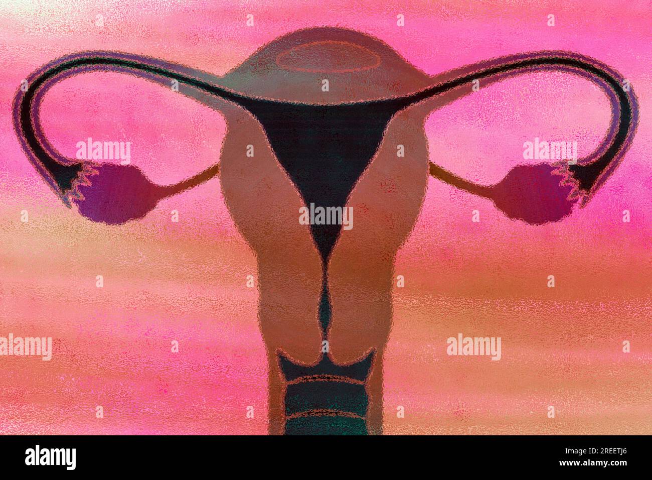 C'est l'utérus et c'est là que mûrit un ovule fécondé Banque D'Images