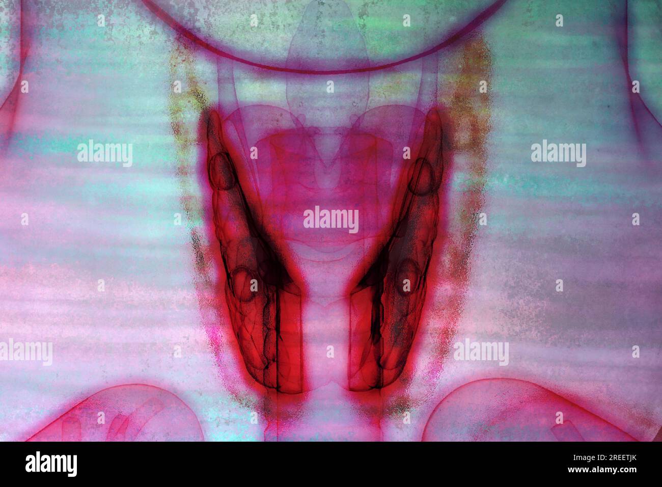 La glande thyroïde est située dans le cou et a de nombreuses tâches dans les domaines du métabolisme, des hormones et de la croissance Banque D'Images