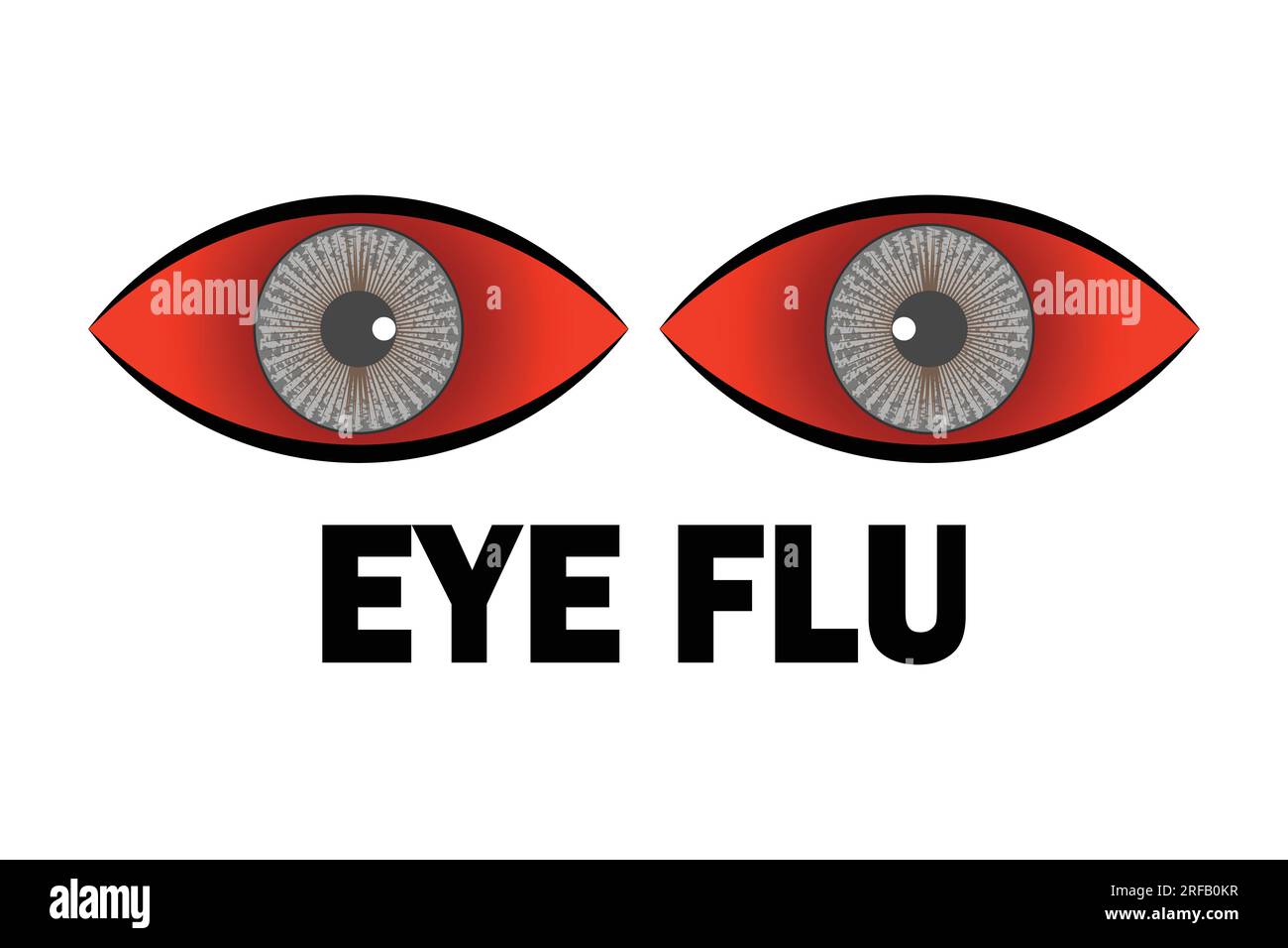 Le virus de la conjonctivite a affecté l'œil rouge, concept d'infection de grippe d'oeil avec la conception d'icône, illustration vectorielle 10 eps graphique. Illustration de Vecteur