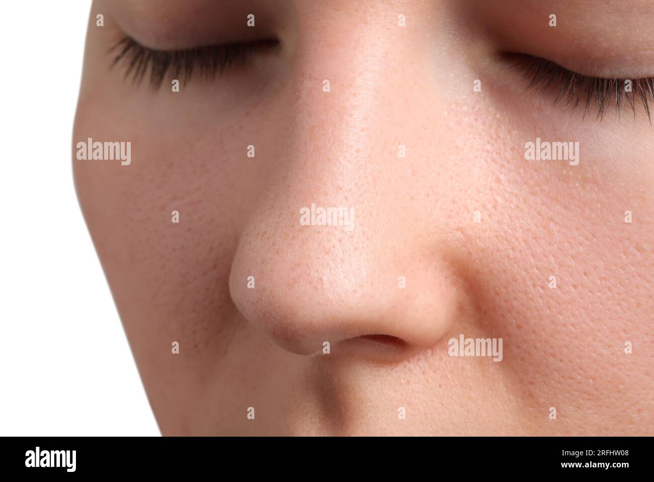 Jeune femme avec problème d'acné sur fond blanc, vue rapprochée Banque D'Images