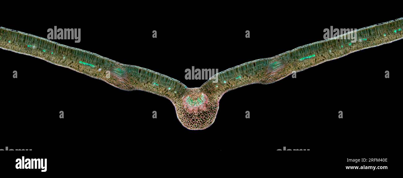 Vantail privet, TS. Ligustrum vulgare, photomicrographe à fond noir Banque D'Images
