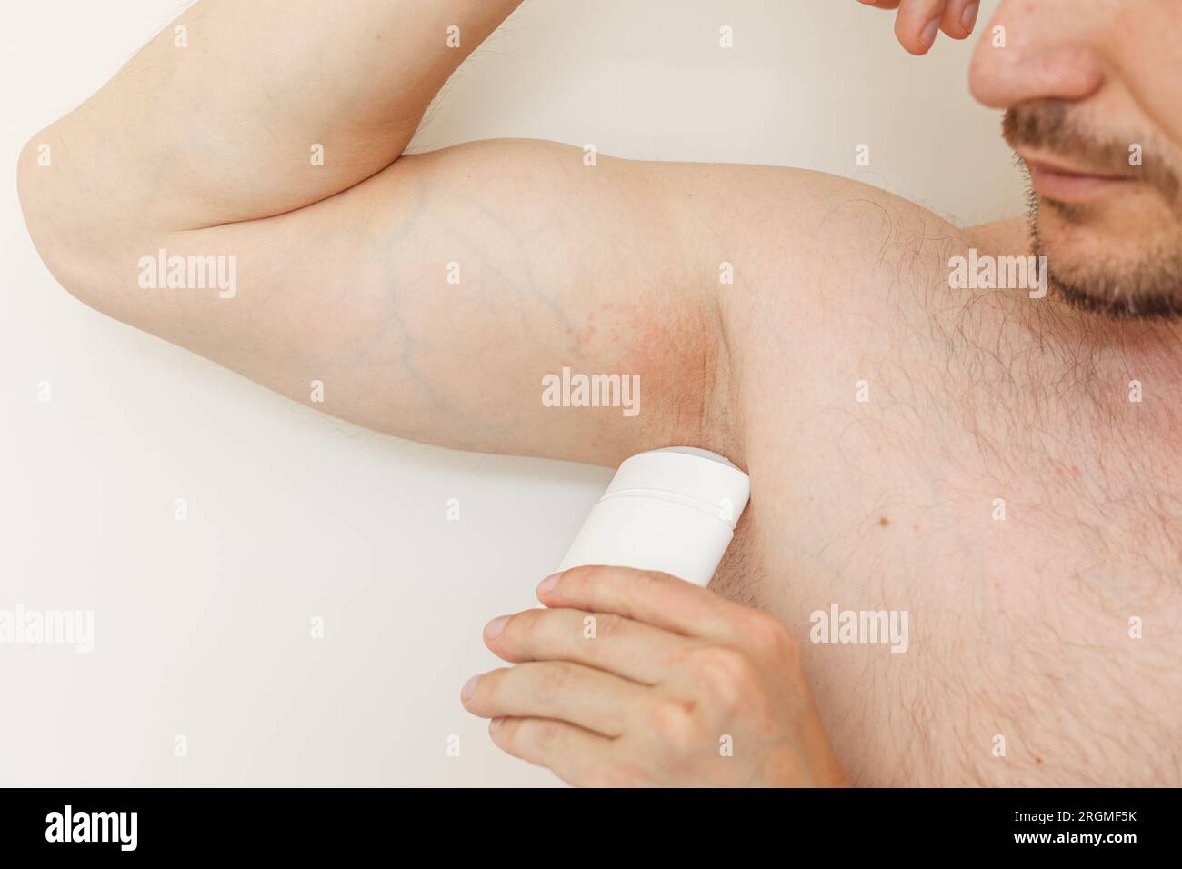 Jeune homme avec irritation, inflammation sur la peau sensible des aisselles,  en utilisant un déodorant ou un antisudorifique pour le traitement de  l'éruption des aisselles. Allergie, derma atopique Photo Stock - Alamy
