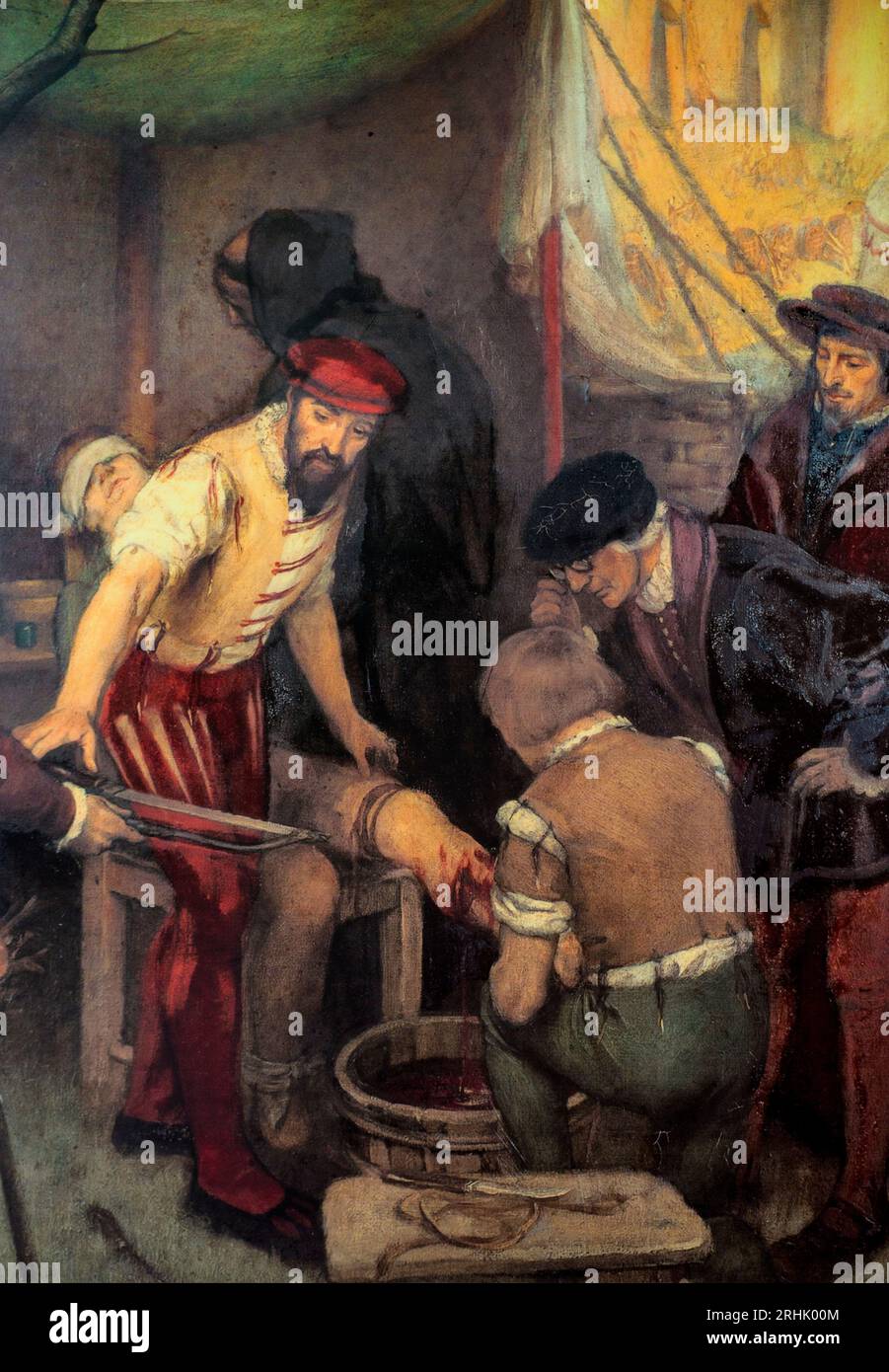 Ambroise paré chirurgie Banque de photographies et d’images à haute