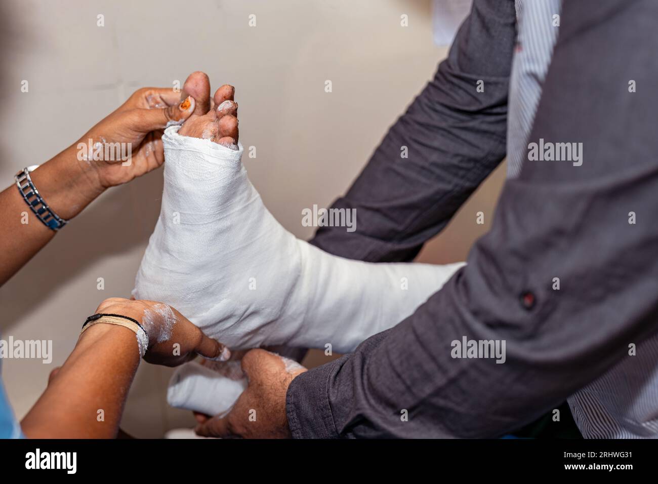 Un médecin et une infirmière appliquent un plâtre moulé sur la jambe d'une femme âgée Banque D'Images