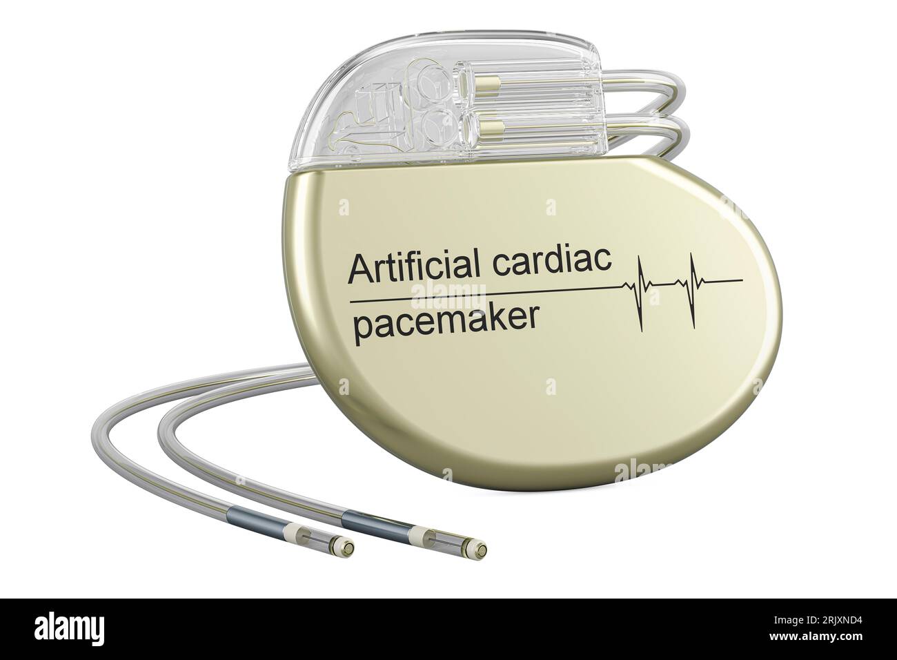 Stimulateur cardiaque artificiel, stimulateur cardiaque artificiel. Rendu 3D isolé sur fond blanc Banque D'Images