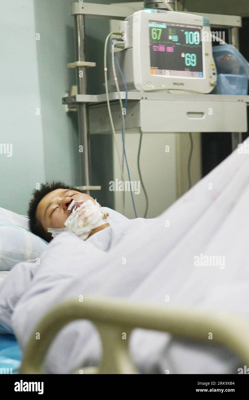 Bildnummer : 54242709 Datum : 20.07.2010 Copyright : imago/Xinhua (100721) -- JIUJIANG, 21 juillet 2010 (Xinhua) -- Un homme blessé par la foudre reçoit un traitement médical dans un hôpital de Jiujiang, dans la province de Jiangxi, dans l'est de la Chine, le 20 juillet 2010. Deux personnes transférées d'un site de réparation de la rive du lac Sixia dans le comté de Xingzi étaient mortes et 15 autres ont été blessées mardi en raison de la foudre. (Xinhua/Hong Xianzhi)(mcg) (1)CHINA-JIANGXI-JIUJIANG-LIGHTNING STRIKE (CN) PUBLICATIONxNOTxINxCHN Gesellschaft Blitz Blitzeinschlag Einschlag Opfer Krankenhaus Behandlung kbdig xsk 2010 Banque D'Images