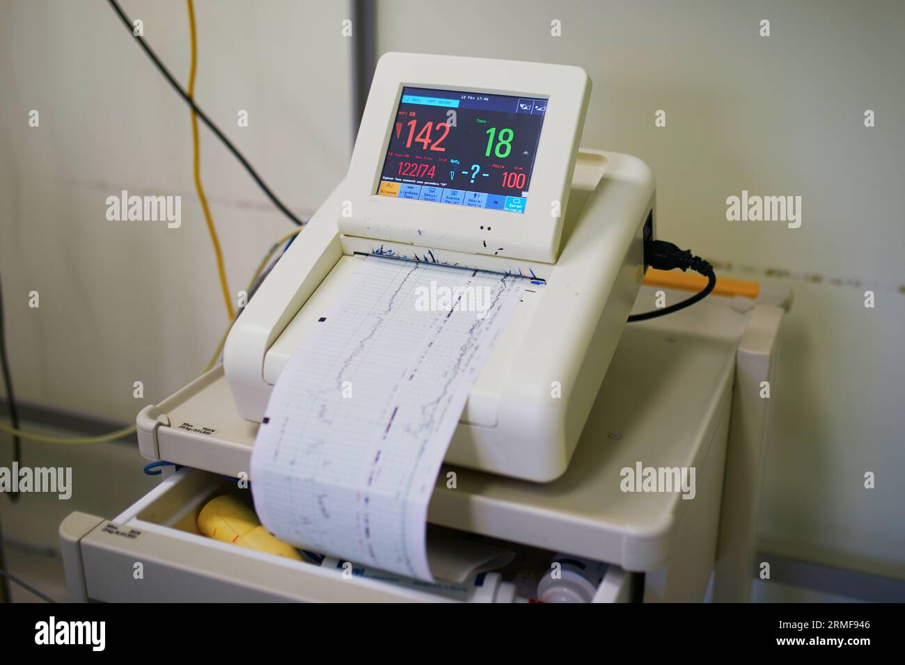 Cardiotocographe enregistrant la fréquence cardiaque foetale et les contractions utérines Banque D'Images