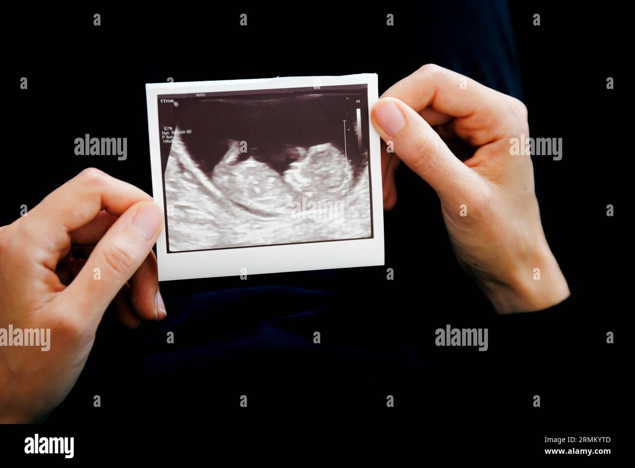 Photo symbolique : enregistrement gestuel au sujet d'une fausse couche. Une femme tient une image échographique d'un enfant à naître dans ses mains. Berlin, 22 août 2023. Banque D'Images