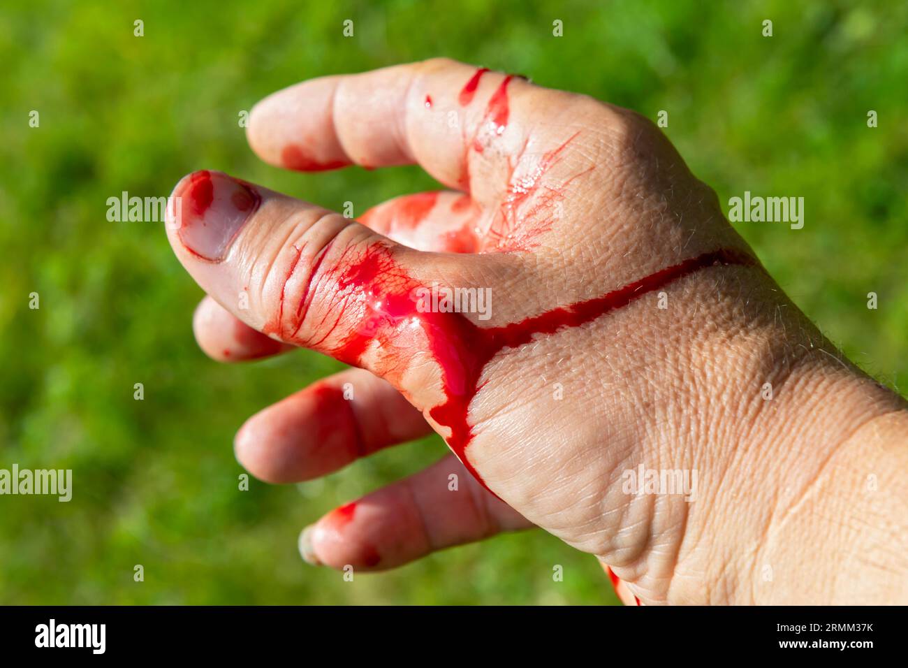 légère blessure sanglante à la main droite Banque D'Images