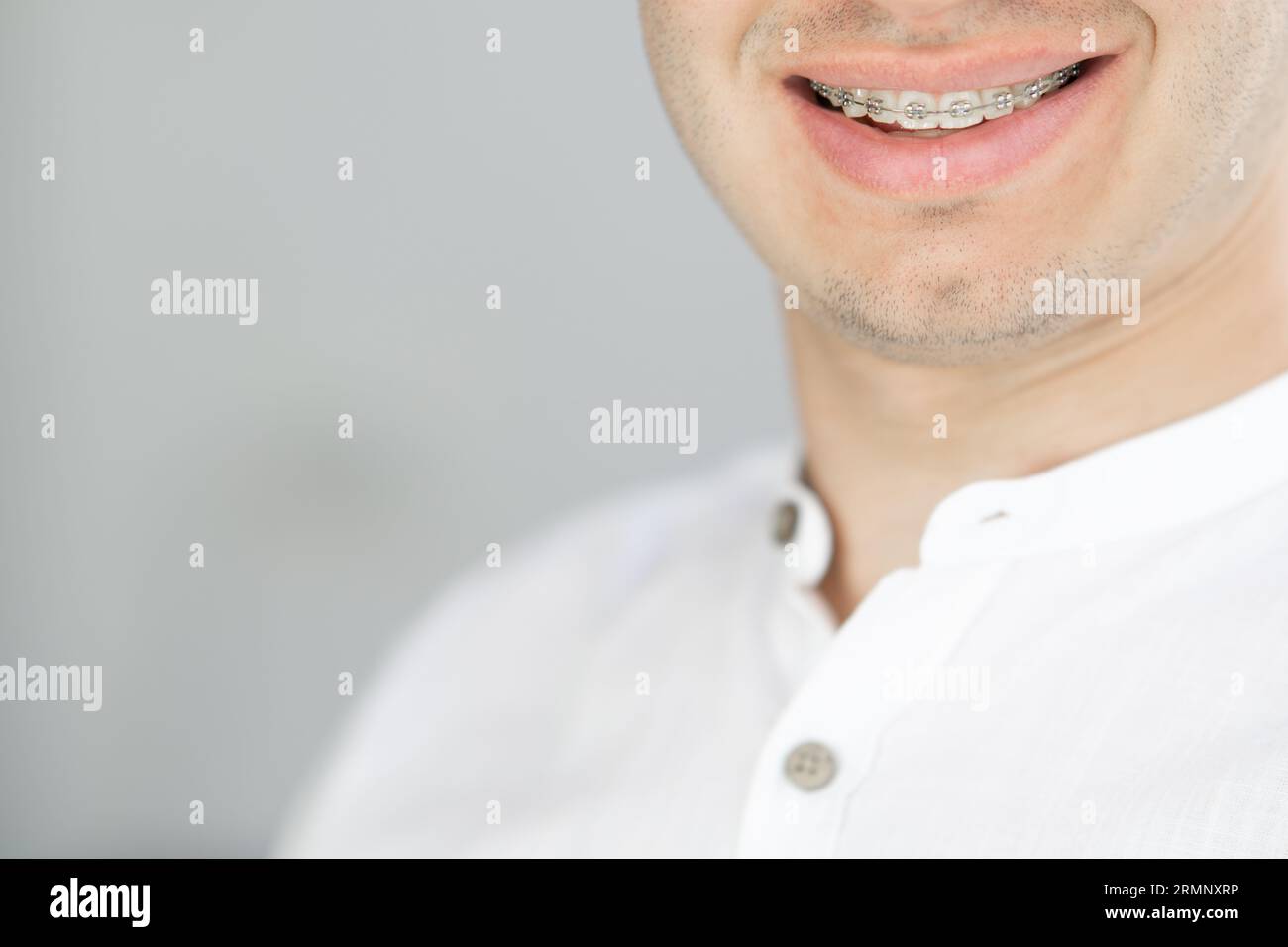 Gros plan du sourire d'un beau jeune homme avec des bretelles souriant avec son bel espace de copie de dents blanches droites. Concept dentaire Banque D'Images