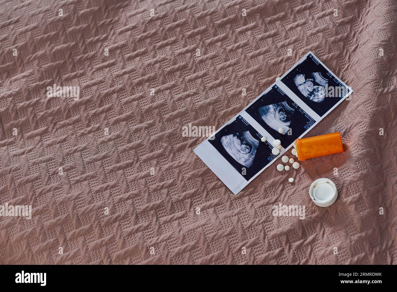 vue de dessus de la bouteille avec pilules, échographie, bébé à naître, contrôle des naissances, chambre à coucher, concept d'avortement Banque D'Images
