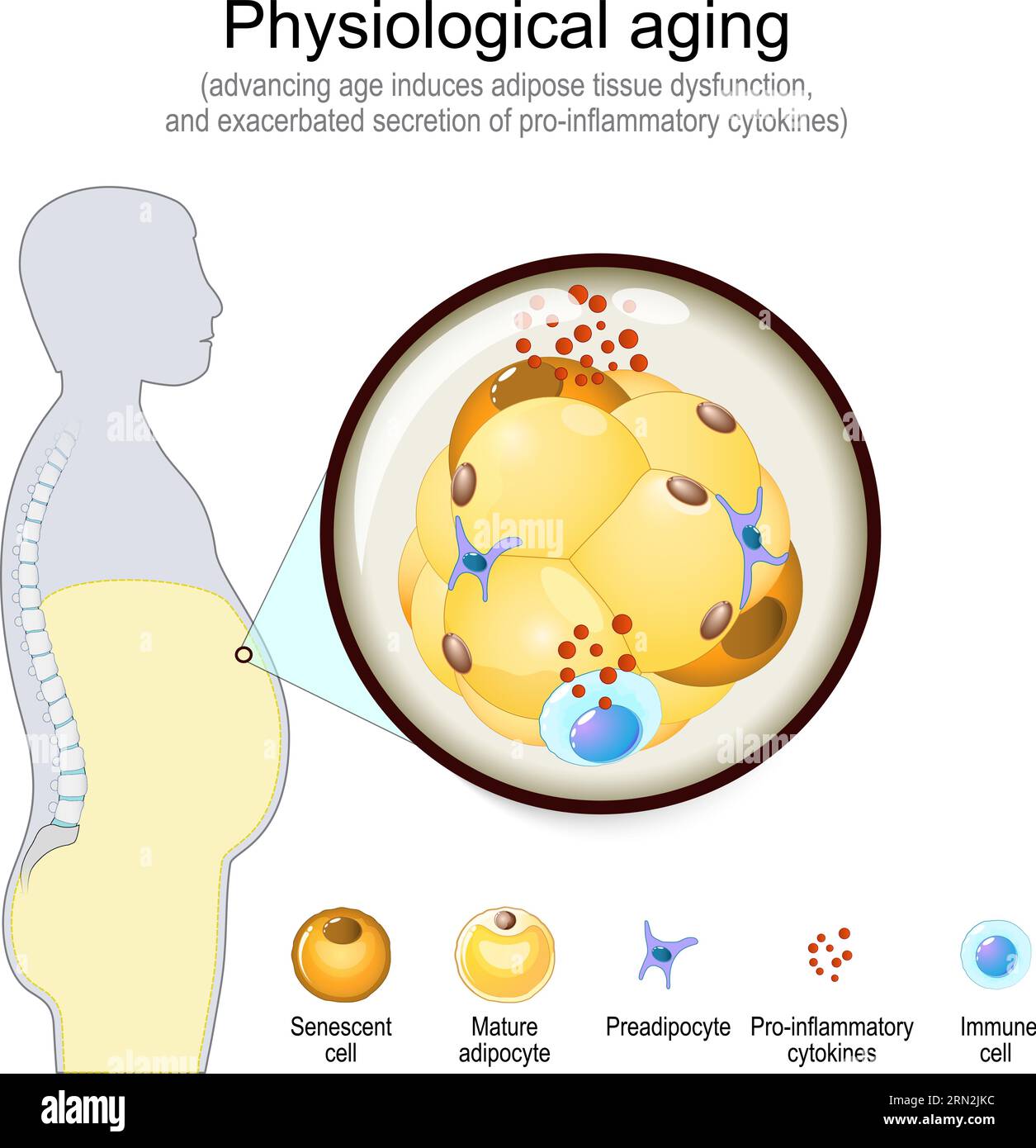 Vieillissement physiologique. Sénescence cellulaire et modifications adipocytaires avec l'âge. Processus de vieillissement, insulinorésistance et diabète. Illustration vectorielle Illustration de Vecteur