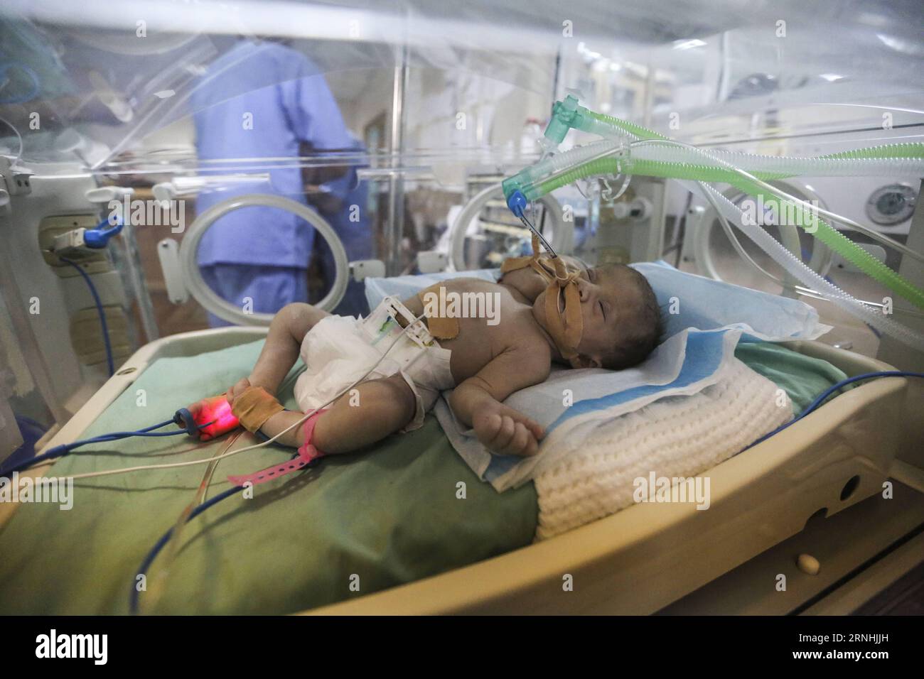 (161123) -- GAZA, 23 novembre 2016 -- des jumeaux palestiniens d'un jour se trouvent dans un incubateur à la crèche le 23 novembre 2016 à l'hôpital al-Shifa de la ville de Gaza.) (gl) JUMELLES CONJOINTES MIDEAST-GAZA WissamxNassar PUBLICATIONxNOTxINxCHN Gaza novembre 23 2016 un jour de PALESTINIENS jumelés jumeaux se trouvent dans un incubateur À la pépinière LE 23 2016 novembre À L'hôpital Al Shifa de Gaza GL Mideast Gaza jumelés Twins WissamxNassar PUBLICATIONxNOTxINxCHN Banque D'Images