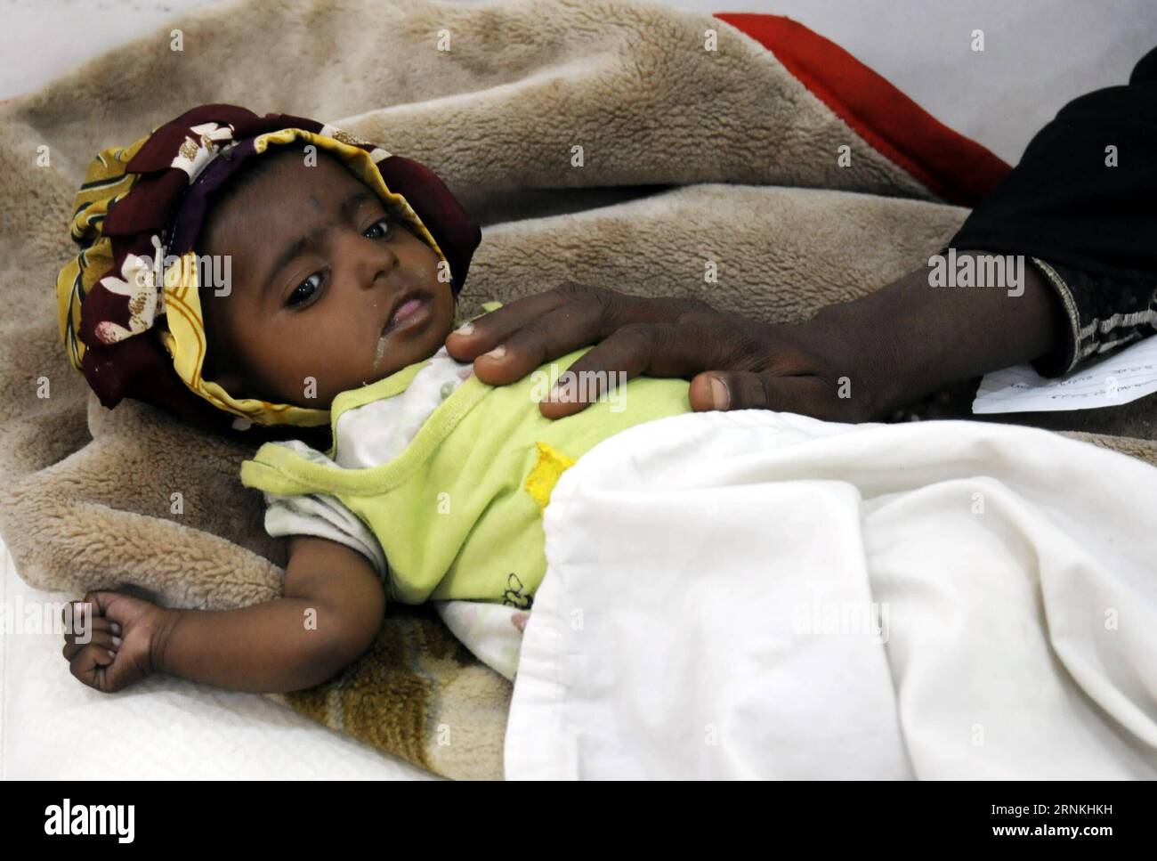 (170402) -- SANAA, 2 avril 2017 -- Une femme pose la main sur son enfant mal nourri en attendant son tour de recevoir un traitement dans un centre d'alimentation thérapeutique à Sanaa, capitale du Yémen, le 2 avril 2017. Quelque sept millions de personnes au Yémen pourraient être menacées par la famine en 2017, a averti Jamie McGoldrick, coordinateur humanitaire des Nations Unies pour le Yémen le 28 mars. McGoldrick a déclaré qu'un alarmant 18,8 millions de Yéménites -- près des deux tiers de la population -- ont besoin d'une sorte de soutien humanitaire ou de protection, a déclaré le porte-parole adjoint de l'ONU Farhan Haq lors d'un briefing quotidien.) LA FEEDIN-YEMEN-SANAA-TH'ERAPEUTIQUE Banque D'Images