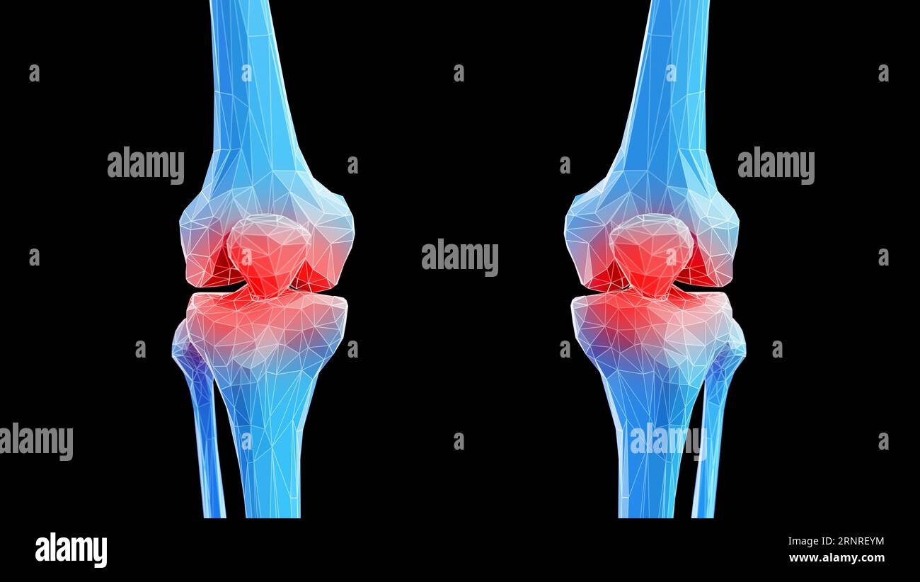 OS du genou, illustration Banque D'Images