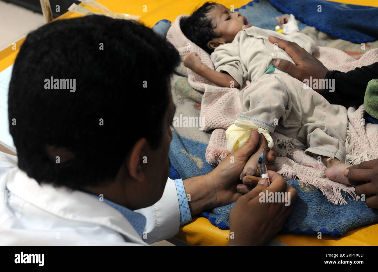 (180804) -- SANAA, 4 août 2018 -- Un médecin obtient du sang d'un enfant pour un examen dans un hôpital de Sanaa, au Yémen, le 4 août 2018. Le nombre croissant de cas de choléra dans plusieurs zones fortement peuplées au cours des dernières semaines indique que le Yémen est peut-être au bord d'une nouvelle épidémie de choléra, avec un taux de mortalité élevé dû à la malnutrition généralisée, et les Nations Unies espèrent un cessez-le-feu dans le nord pour permettre les vaccinations, a déclaré vendredi l'Organisation mondiale de la Santé. YÉMEN-SANAA-POUSSÉE ÉPIDÉMIQUE DE CHOLÉRA MohammedxMohammed PUBLICATIONxNOTxINxCHN Banque D'Images