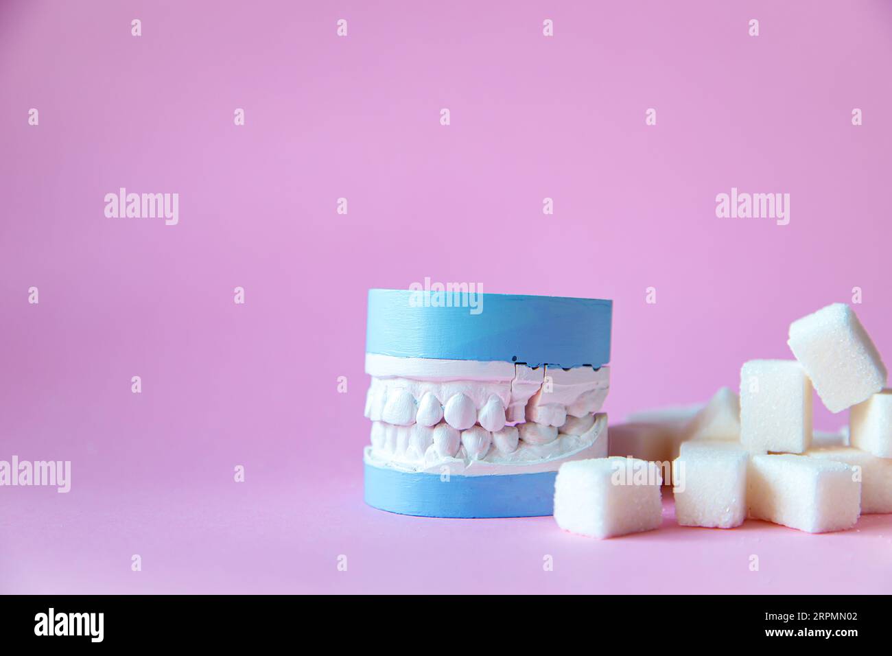 Modèle en plâtre de la mâchoire avec des cubes de sucre sur un fond rose. Les bonbons sont mauvais pour les dents. Banque D'Images