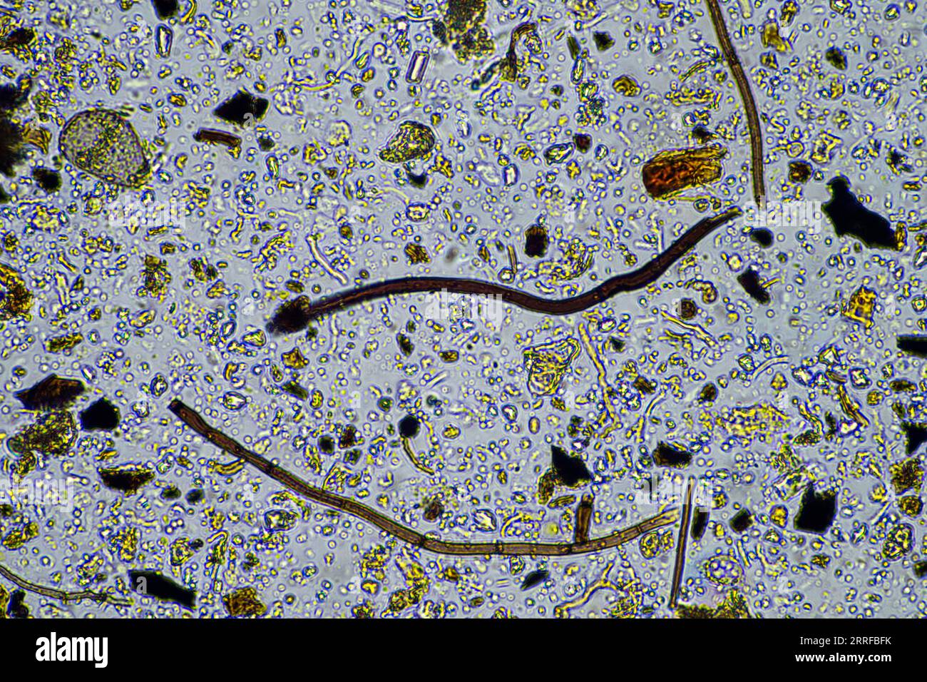 vie du sol au microscope avec champignons du sol et hyphes fongiques dans une ferme Banque D'Images