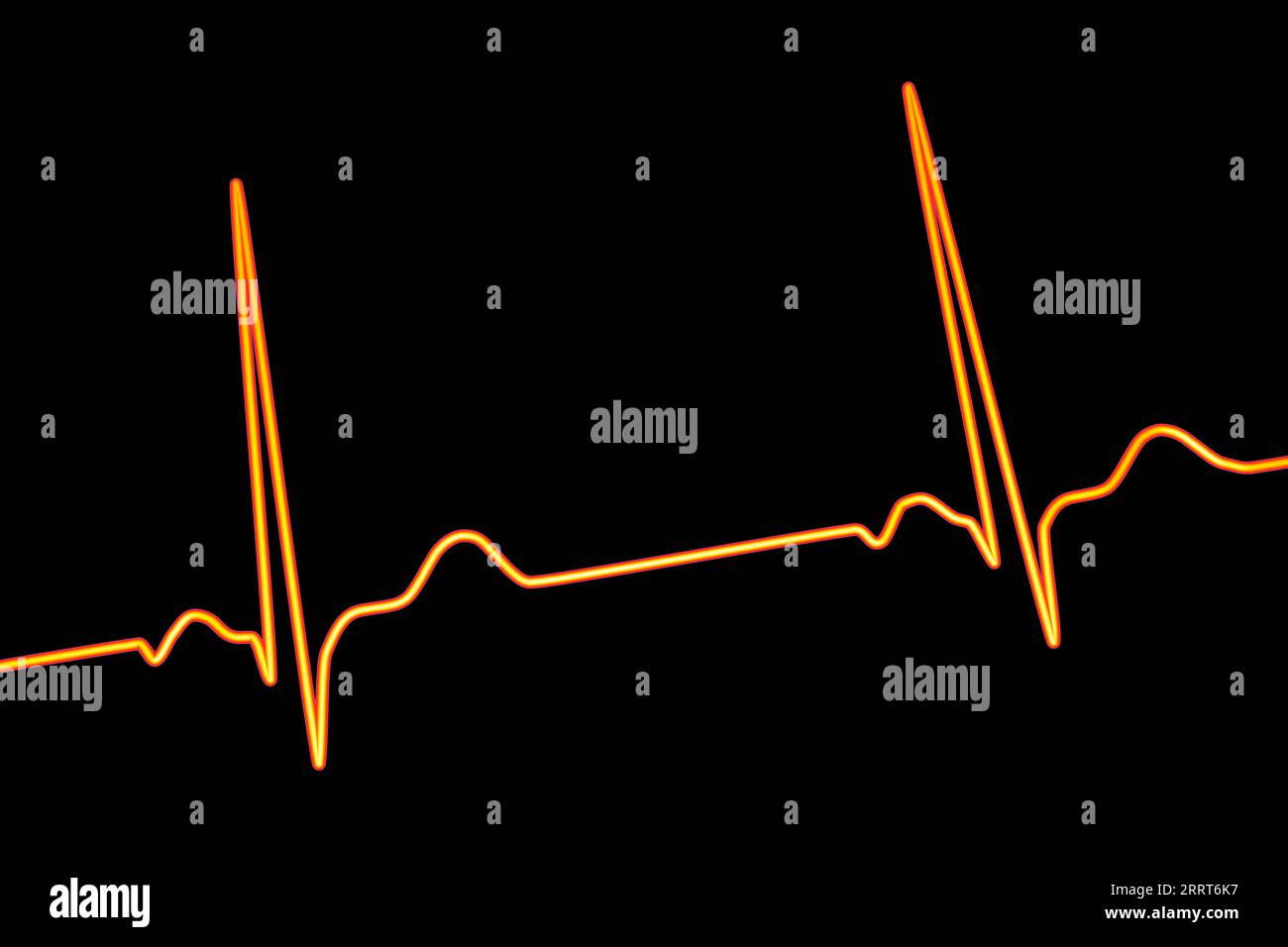 Rythme cardiaque sain, illustration Banque D'Images