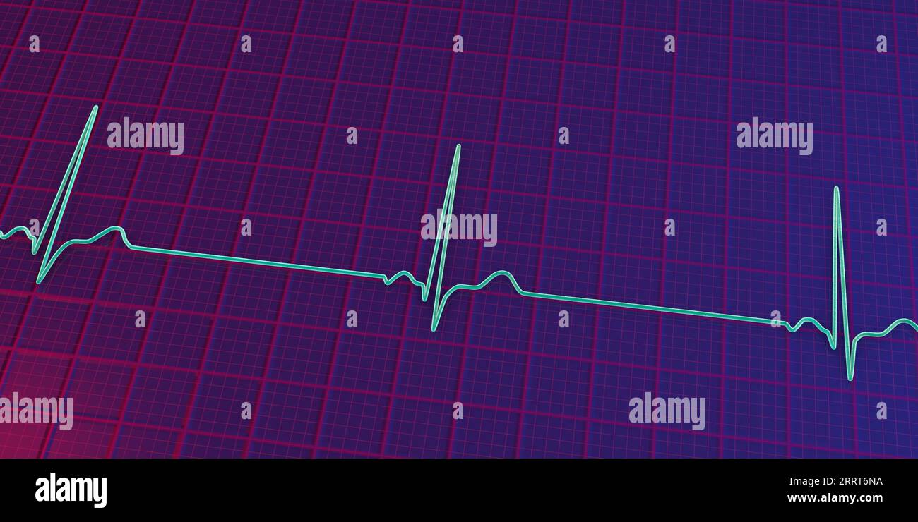 rythme-cardiaque-lent-banque-de-photographies-et-d-images-haute