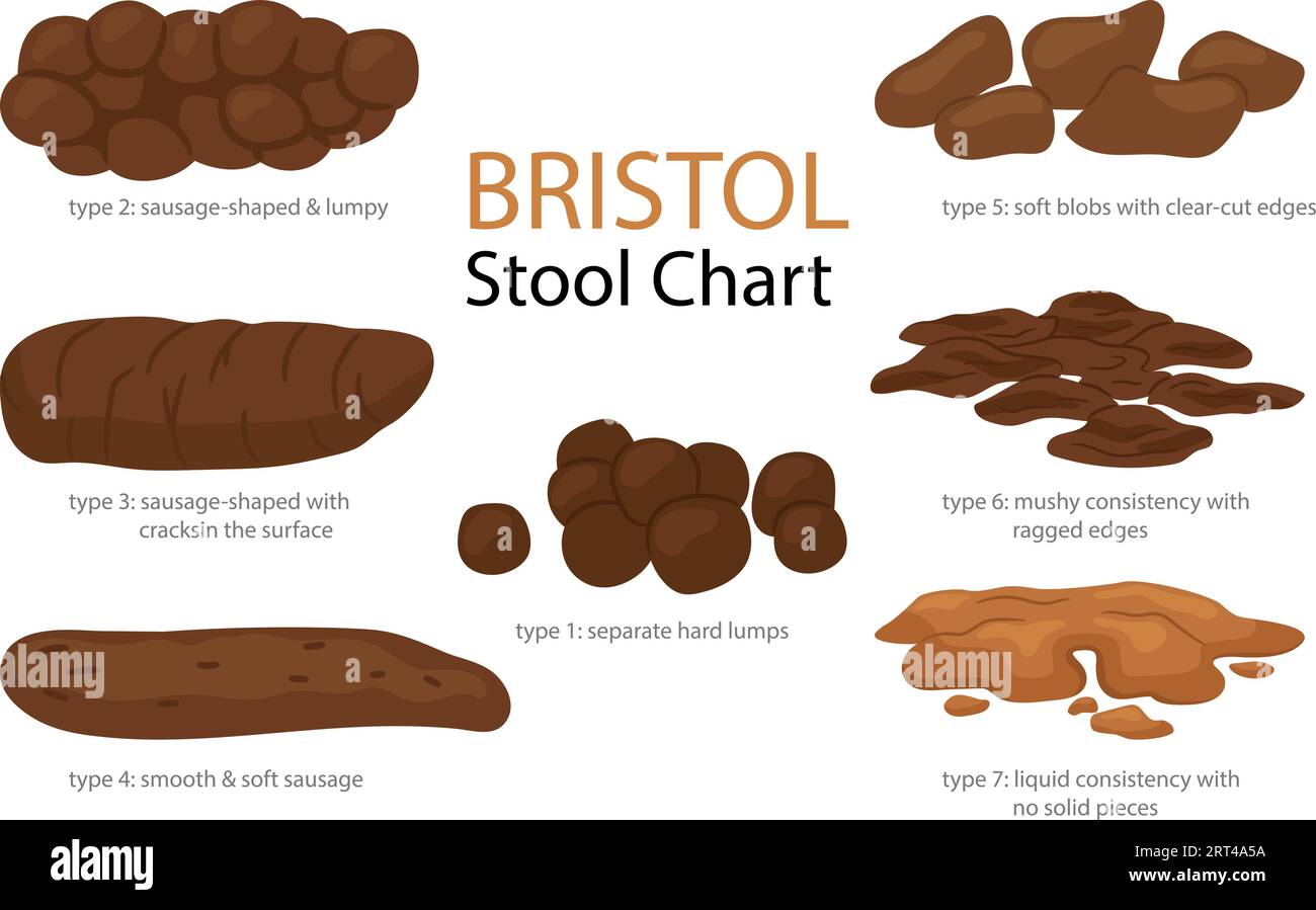 Echelle de forme de selles Bristol avec des images de type fèces. Ensemble de différents types de matières fécales humaines, excréments dans la normale et les maladies de diarrhée et de constipation. Illustration de dessin animé isolé de vecteur Illustration de Vecteur