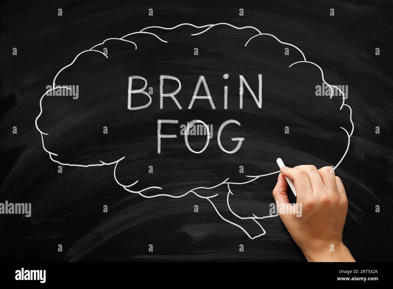 Dessin à la main concept de brouillard cérébral sur les problèmes de mémoire, le manque de clarté mentale et une incapacité à se concentrer. Banque D'Images