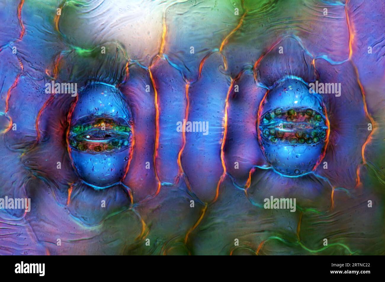 L'image présente des stomates dans l'épiderme foliaire de Spathiphyllum, photographiés au microscope en lumière polarisée à un grossissement de 400X. Banque D'Images