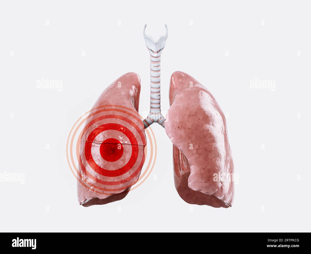 Concept de maladie ou de douleur des poumons humains isolés sur blanc avec signe de douleur rouge dessus. illustration 3d. Banque D'Images