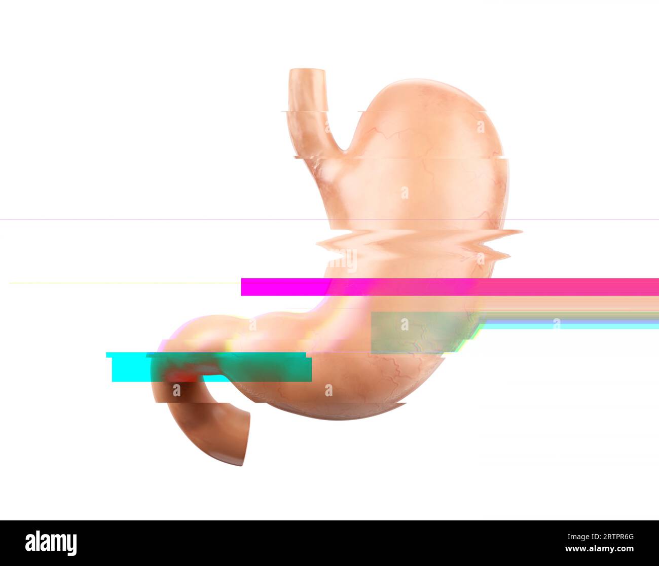 Illustration réaliste 3d du modèle anatomique de l'estomac humain avec effet de pépin, échec ou concept de maladie Banque D'Images