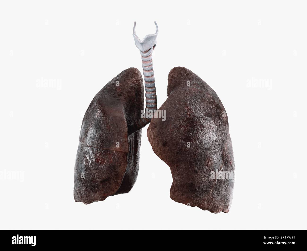 Illustration réaliste 3d des poumons de fumeur malade isolé sur fond blanc. Vue de face des poumons humains dmagés Banque D'Images