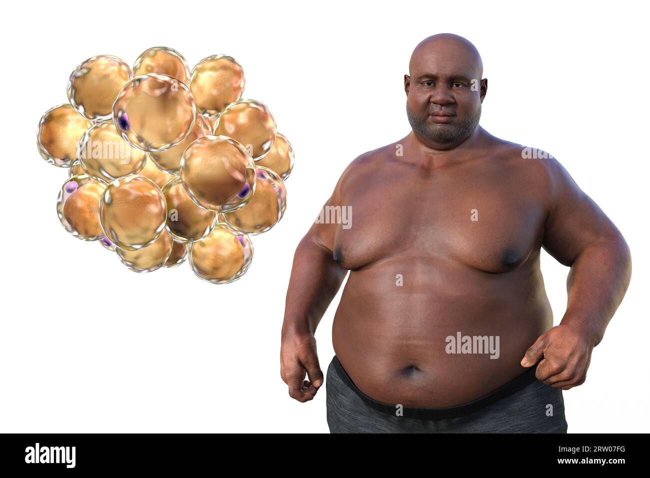 Homme en surpoids avec adipocytes, illustration Banque D'Images