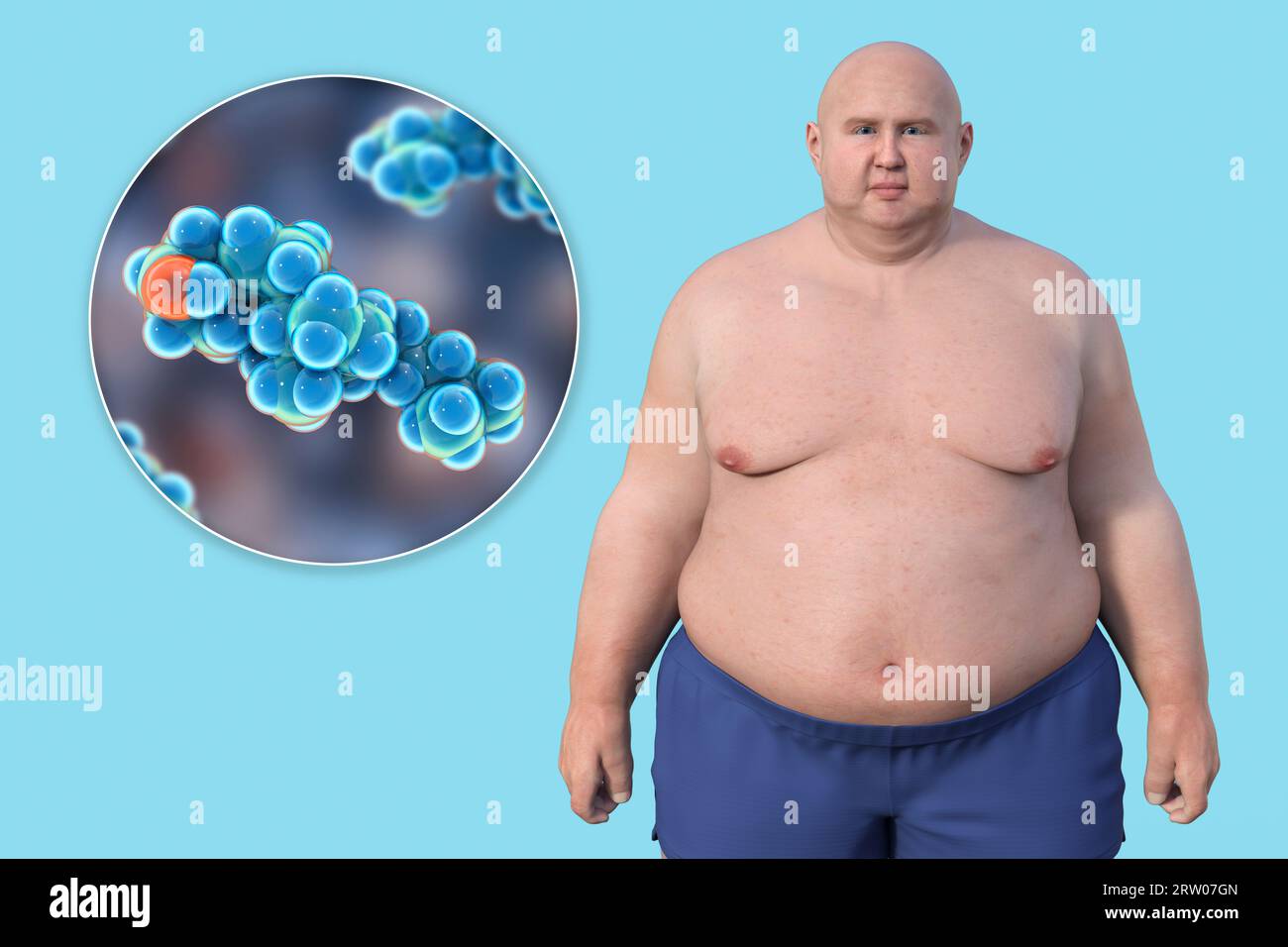 Homme en surpoids et molécule de cholestérol, illustration Banque D'Images