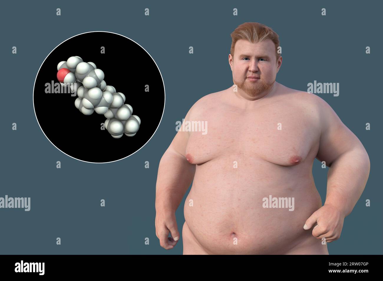 Homme en surpoids et molécule de cholestérol, illustration Banque D'Images