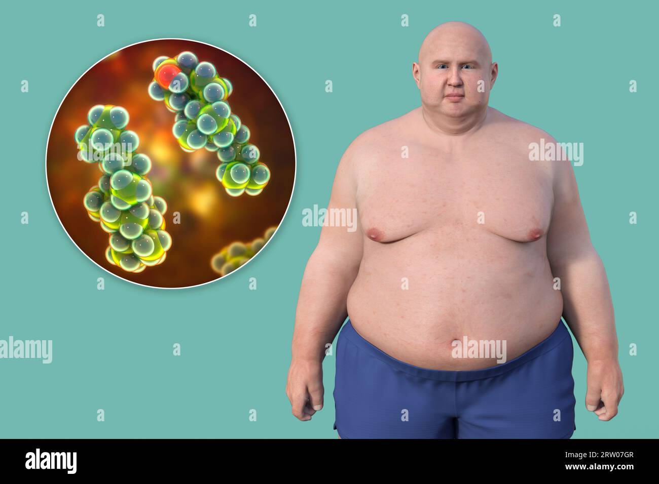Homme en surpoids et molécule de cholestérol, illustration Banque D'Images