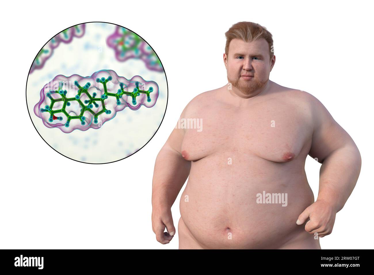 Homme en surpoids et molécule de cholestérol, illustration Banque D'Images